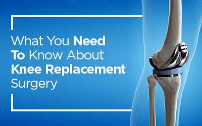 What You Need To Know About Knee Replacement Surgery