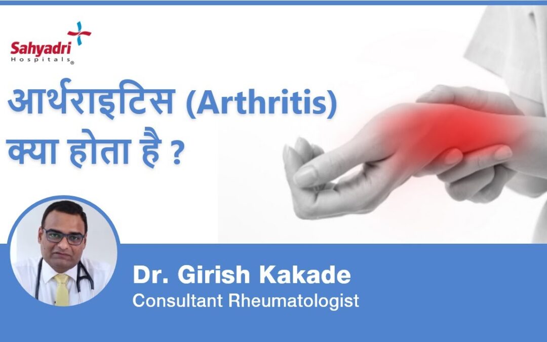 आर्थराइटिस (Arthritis) क्या होता है?