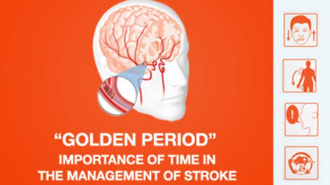 Golden period”: Importance of time in the management of stroke - Sahyadri  Hospital