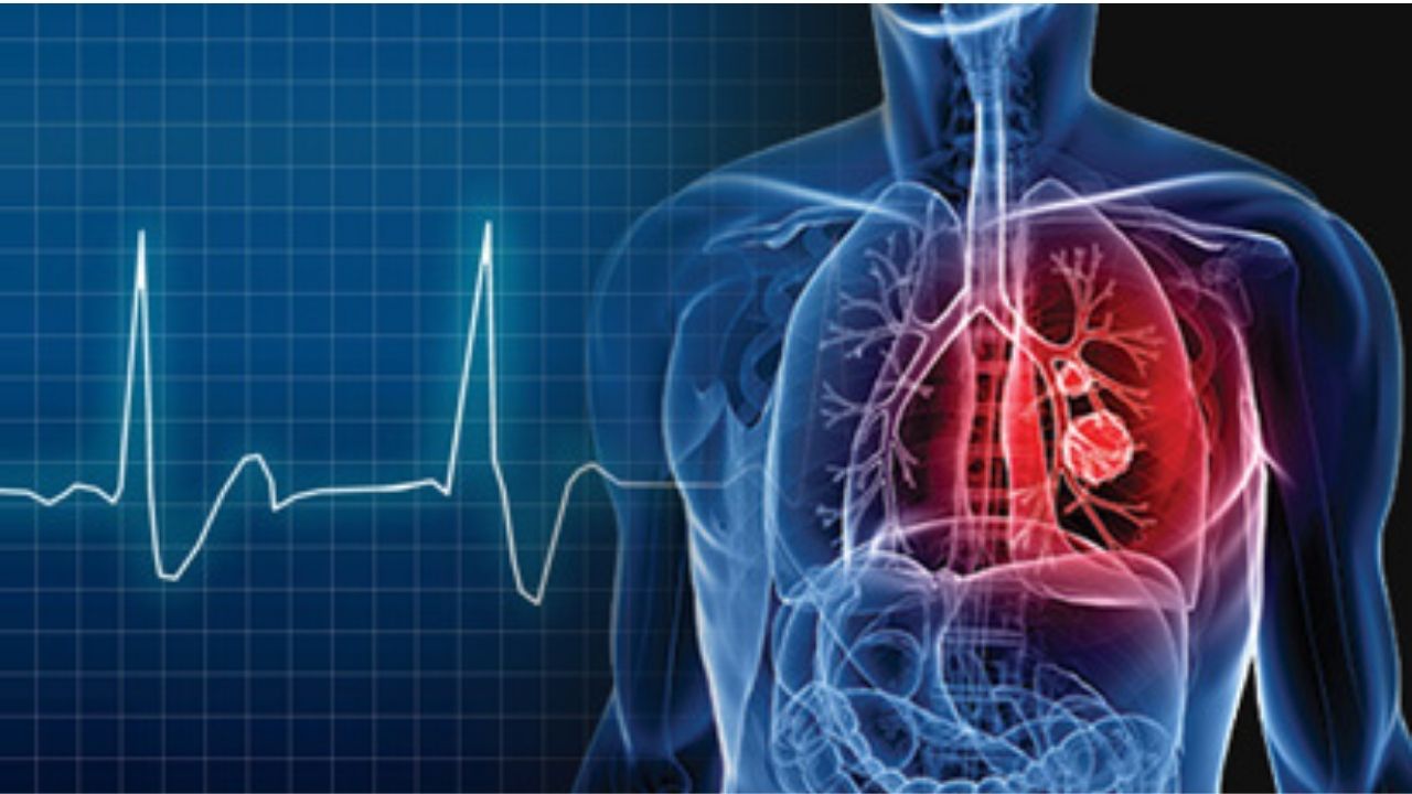 Electrophysiology Sahyadri Hospital