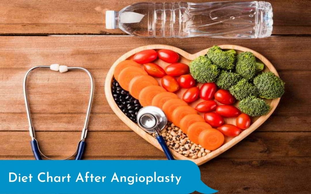 What Should Be the Diet Chart After Angioplasty?