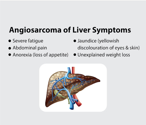 Angiosarcoma of liver symptoms