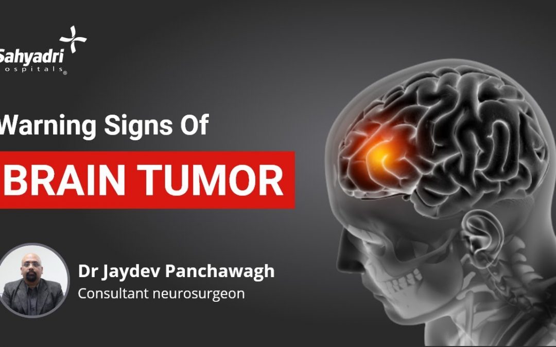What Are The Early Symptoms of a Brain Tumor?