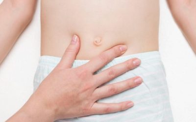 What Are the Signs and Symptoms of Umbilical Hernia?