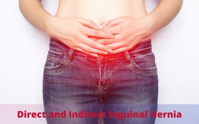 Difference Between Direct and Indirect Inguinal Hernia