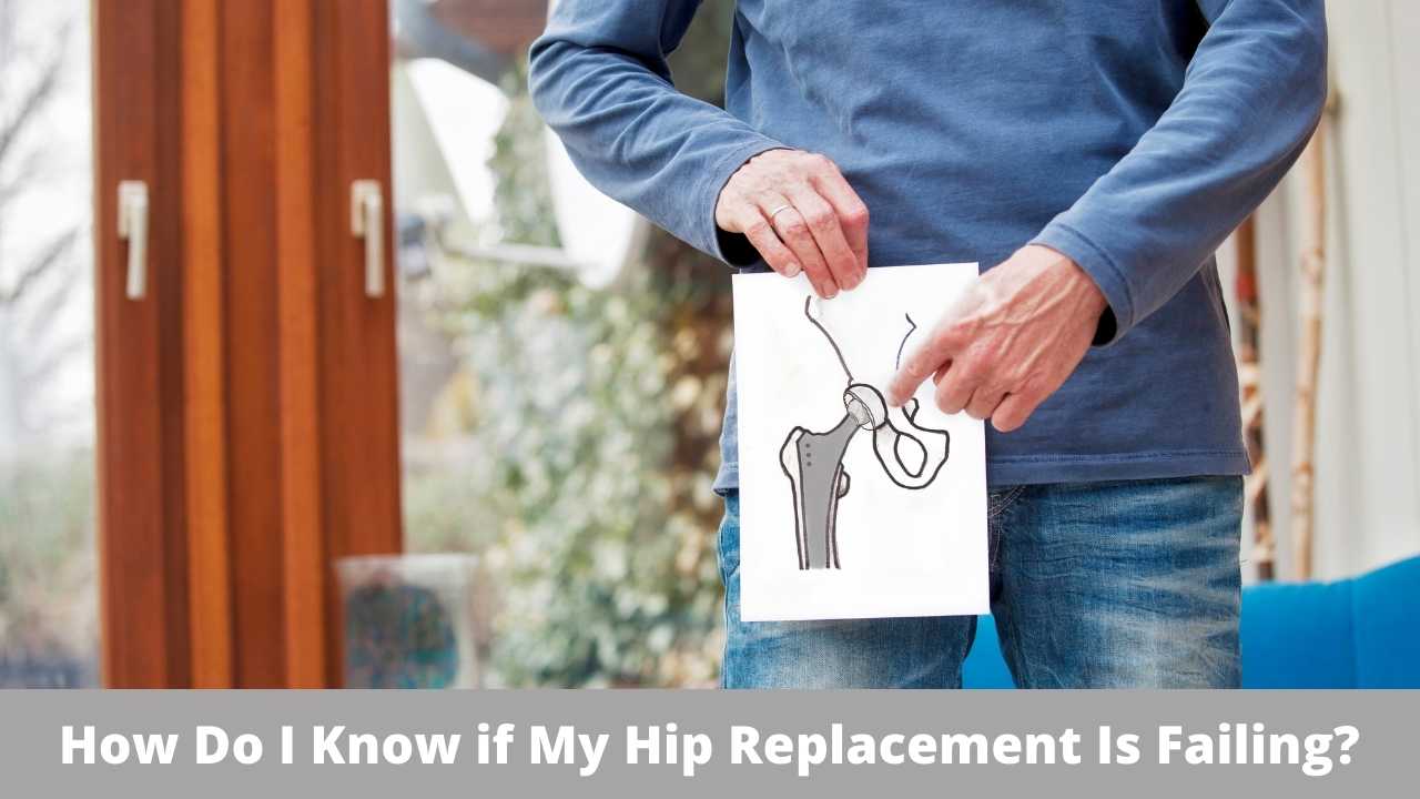 How+Do+I+Know+if+My+Hip+Replacement+Is+Failing