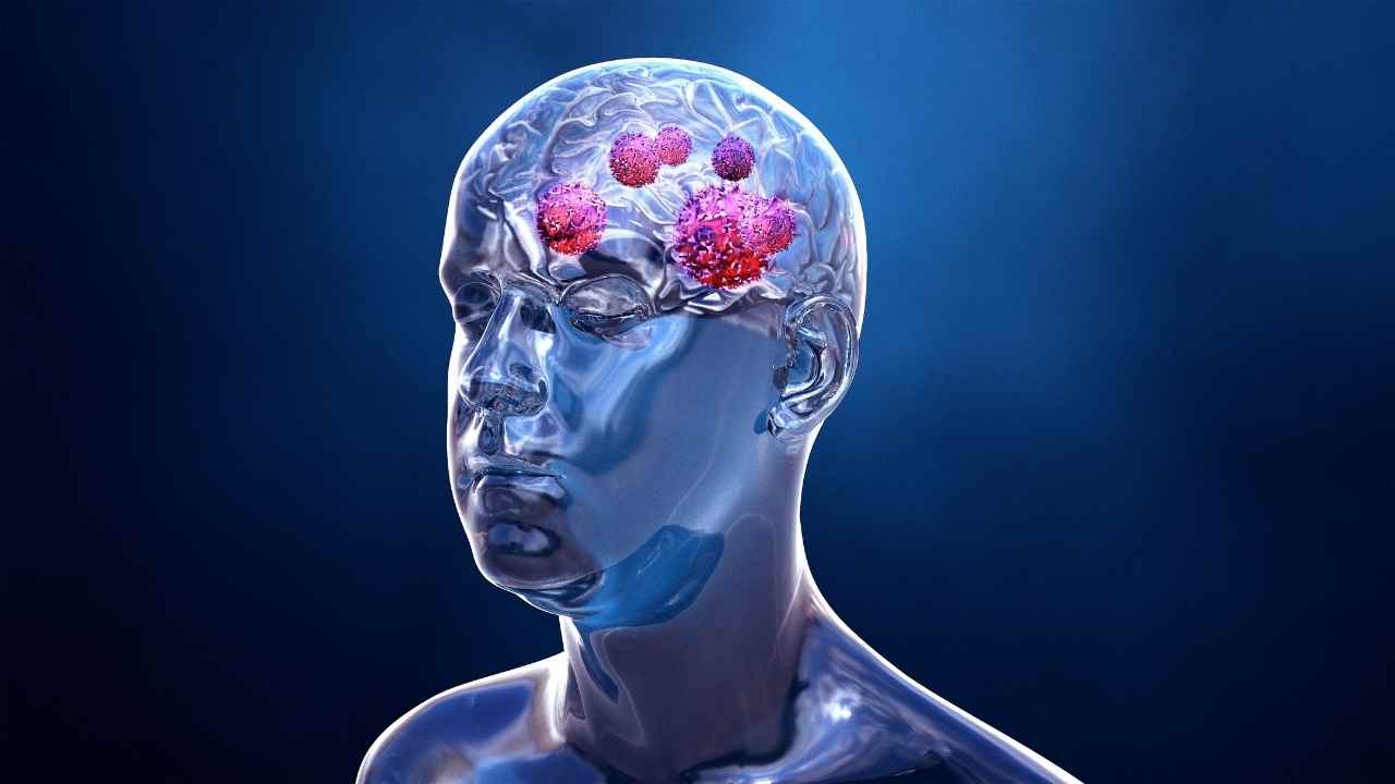 Can Brain Tumors Be Cured Types Of Brain Tumor Sahyadri Hospital