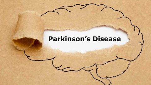 पार्किन्सन म्हणजे काय?