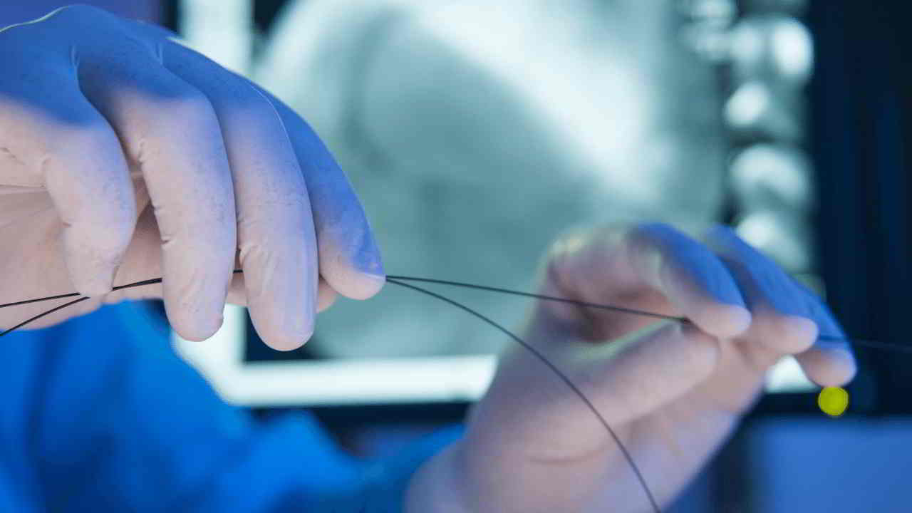 fda-considers-first-ever-disappearing-heart-stent-future-of-you