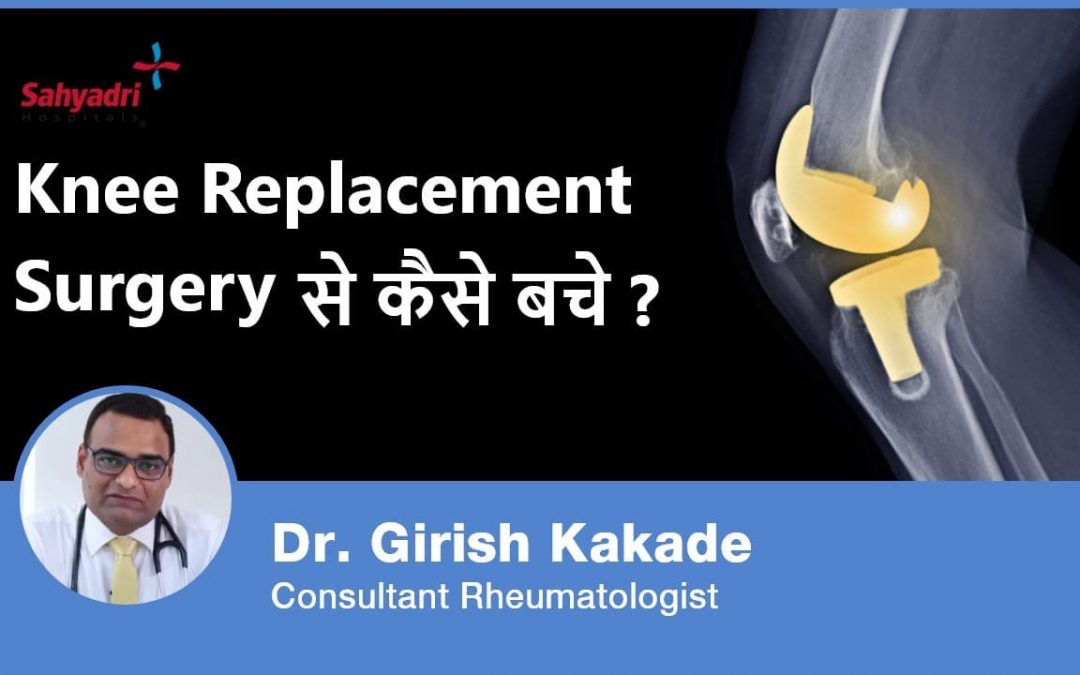 Knee Replacement Surgery: How to Avoid It?