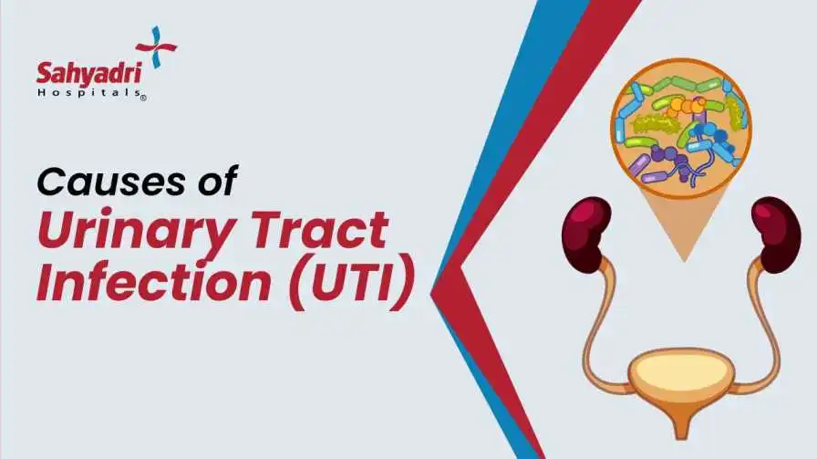 Causes of Urinary tract infection (UTI)