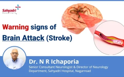 Warning Signs of Brain Stroke