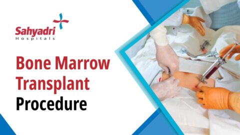Bone marrow transplant procedure