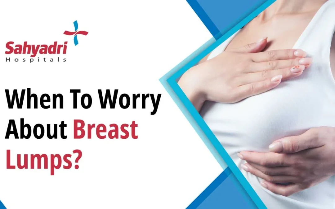 When to Worry About Breast Lumps? A Comprehensive Guide to Breast Health
