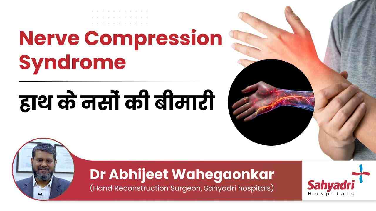 Nerve Compression Syndromes: Causes, Symptoms and Treatment
