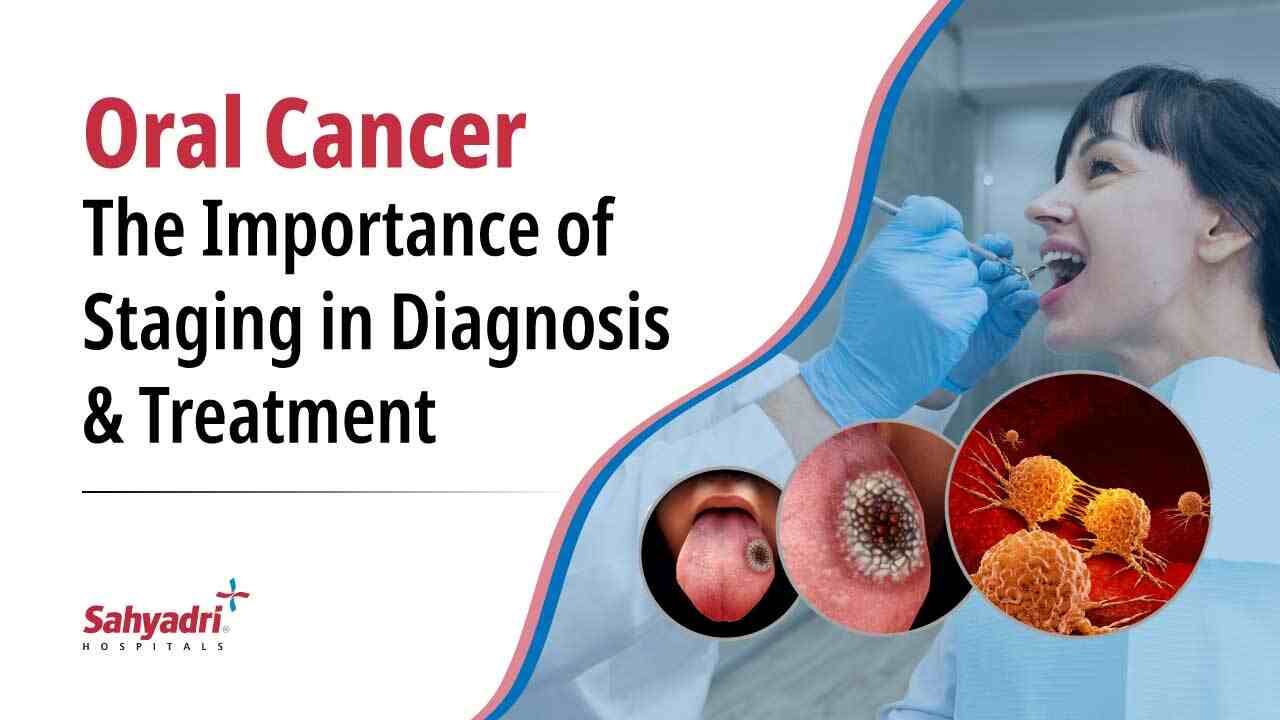 Oral Cancer: The Importance of Staging in Diagnosis and Treatment
